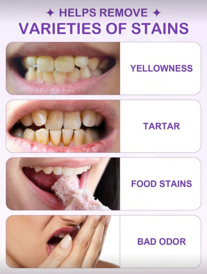 Purple teeth whitening strips (14 strips)