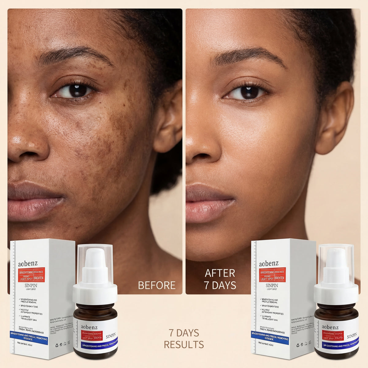 Aobenz dark spot remover serum